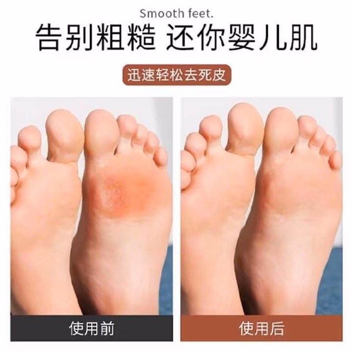 Chà Gót Dùng Được 2 Mặt, Chân Ái Cho Mọi Người - Ảnh 4