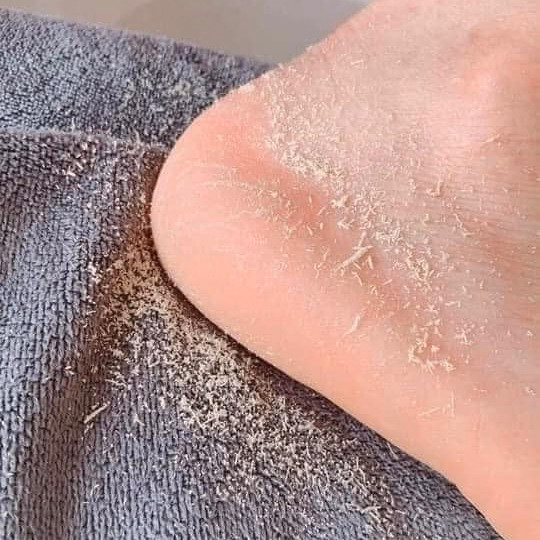 Chà Gót Dùng Được 2 Mặt, Chân Ái Cho Mọi Người - Ảnh 5