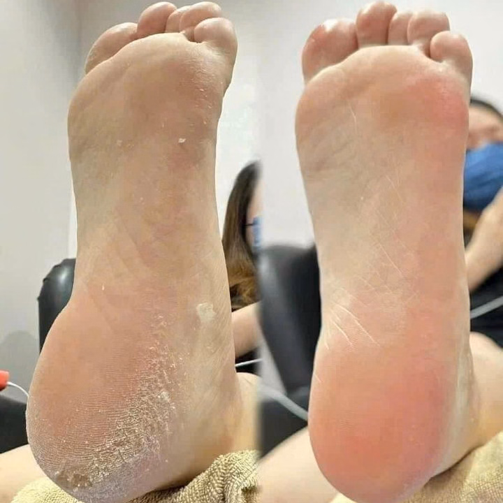 Chà Gót Có 2 Mặt, Dùng Cho Mọi Người Siêu Tiện Lợi - Ảnh 6